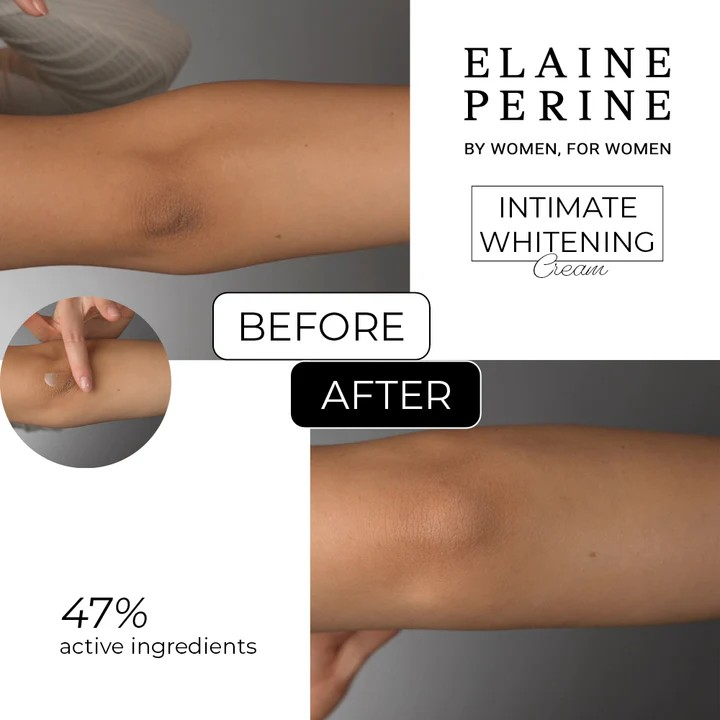 intimate whitening kreem intiimpiirkondade valgendamiseks 50ml